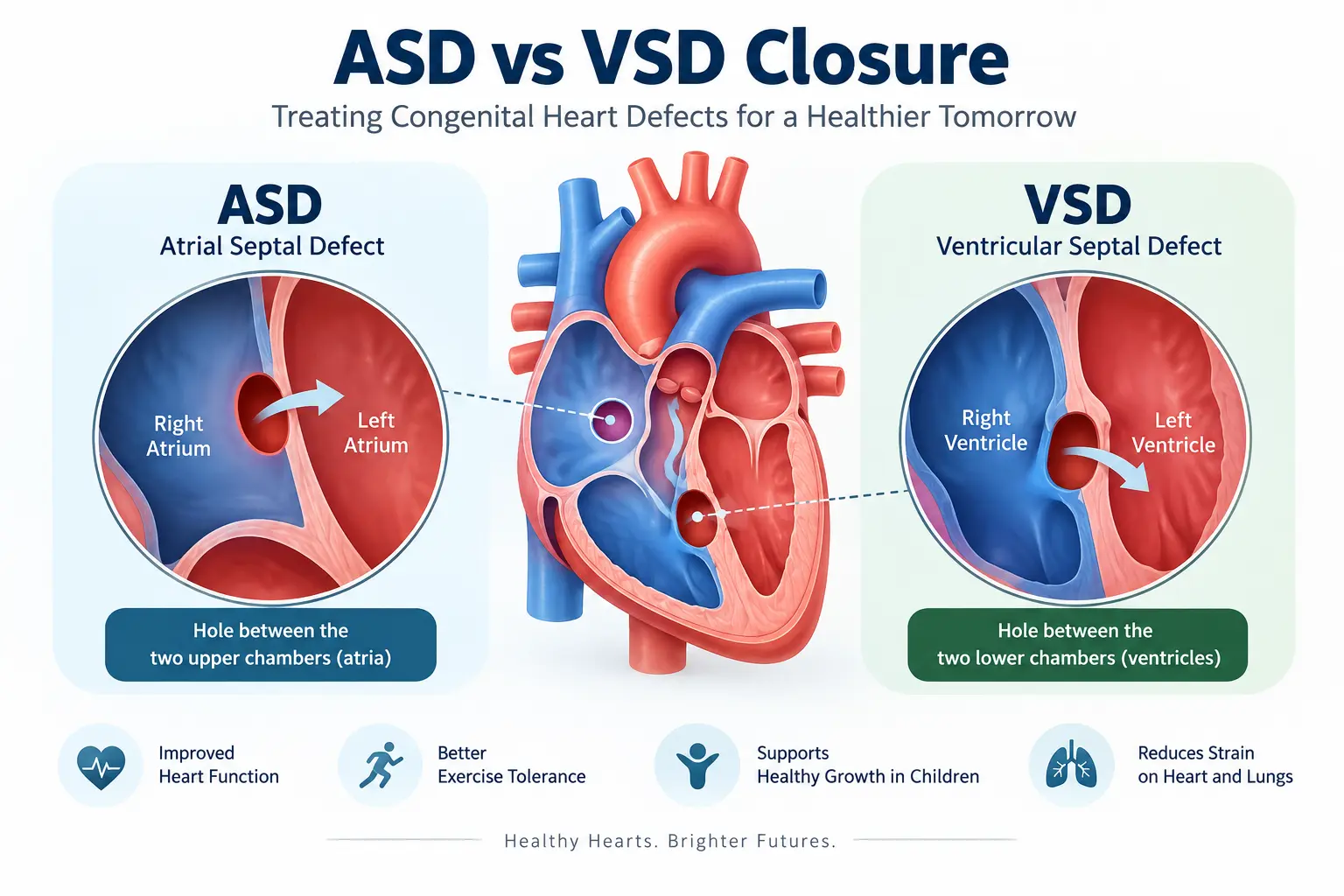 ASD vs VSD Closure in India