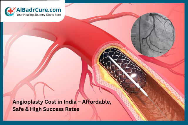 Angioplasty Cost in India | Affordable Heart Treatment