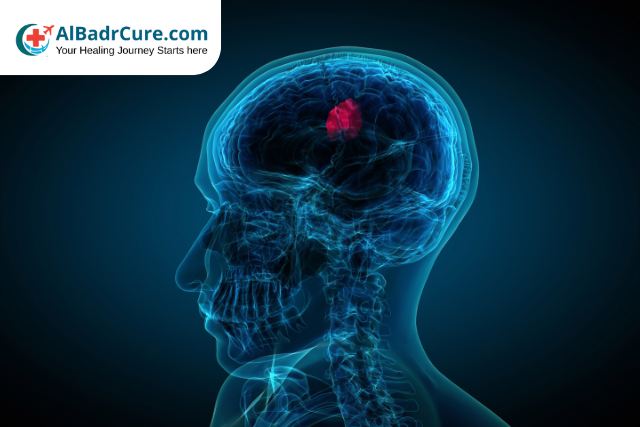 Brain Tumour Surgery in India – Top Hospitals & Doctors